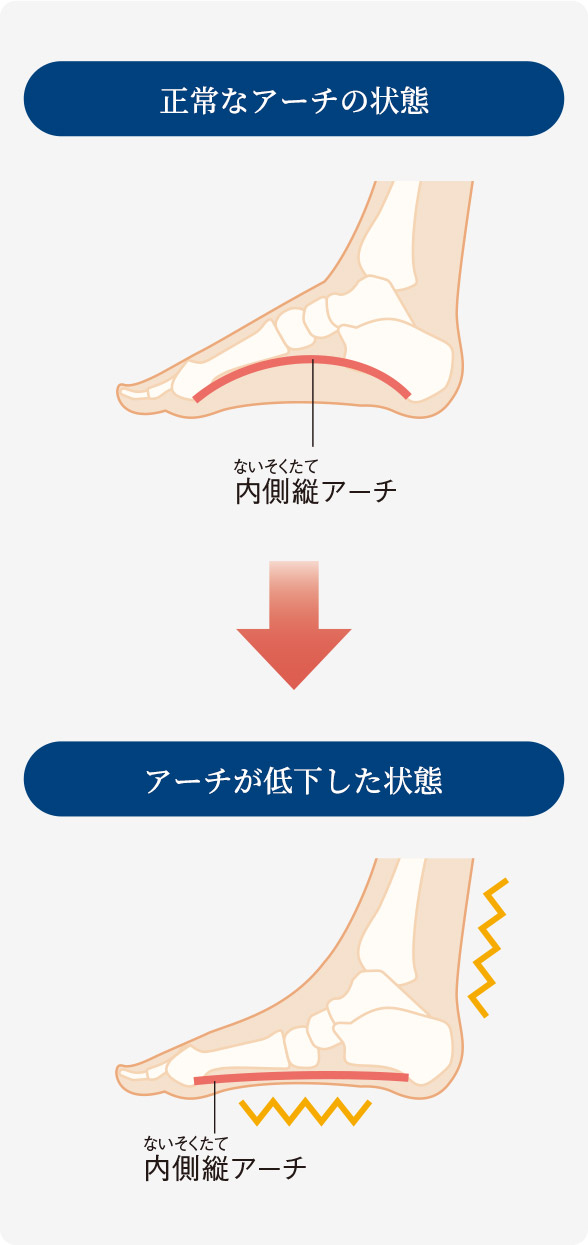 足根骨を動かして扁平足を改善 ファイテン式 足根骨マッサージ とは 製品情報 Phiten Life Technology ファイテン ライフテクノロジー