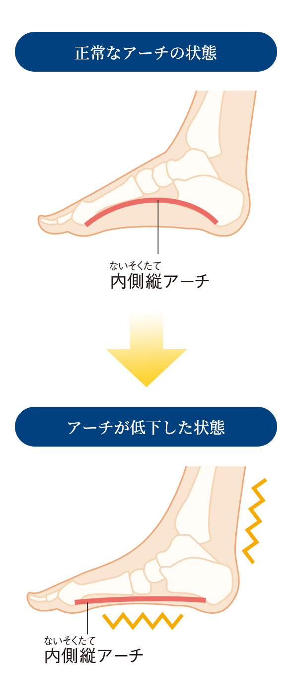 足裏の縦アーチにアプローチ フットマッサージャー ソラーチ バーティカル 製品情報 Phiten Life Technology ファイテン ライフテクノロジー 足裏の縦アーチにアプローチ フットマッサージャー ソラーチ バーティカル 製品情報 Phiten Life Technology ファイテン ライフテクノロジー